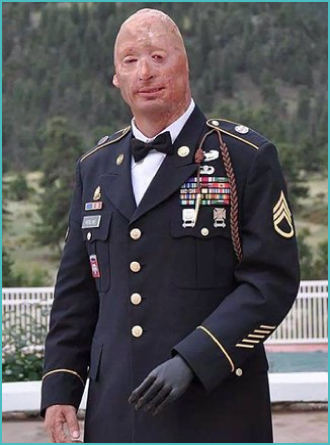 SSG Bobby Henline wearing miliatry uniform